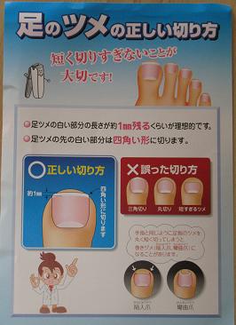 足の爪は四角に切るのが正しい 深爪は要注意 自家焙煎コーヒー Gaya通信 足の爪は四角に切るのが正しい 深爪は要注意 自家焙煎コーヒー Gaya通信