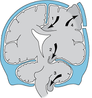 Second Impact Syndromeは本当に存在するのか。_b0112009_9405162.png