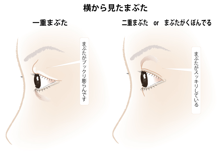 一重まぶた徹底的に分析 もっと綺麗に