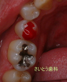 b0196070_22313132.jpg