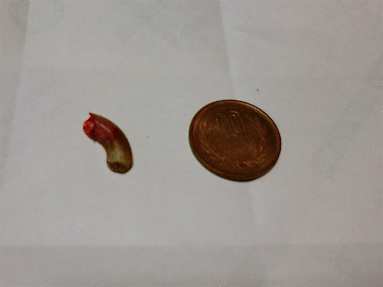 今度は生爪はがし事件 ゞ Nile Saloon Diary 今度は生爪はがし事件 ゞ Nile Saloon Diary