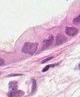 Clara細胞の発見者:Max Clara_e0156318_21473124.jpg
