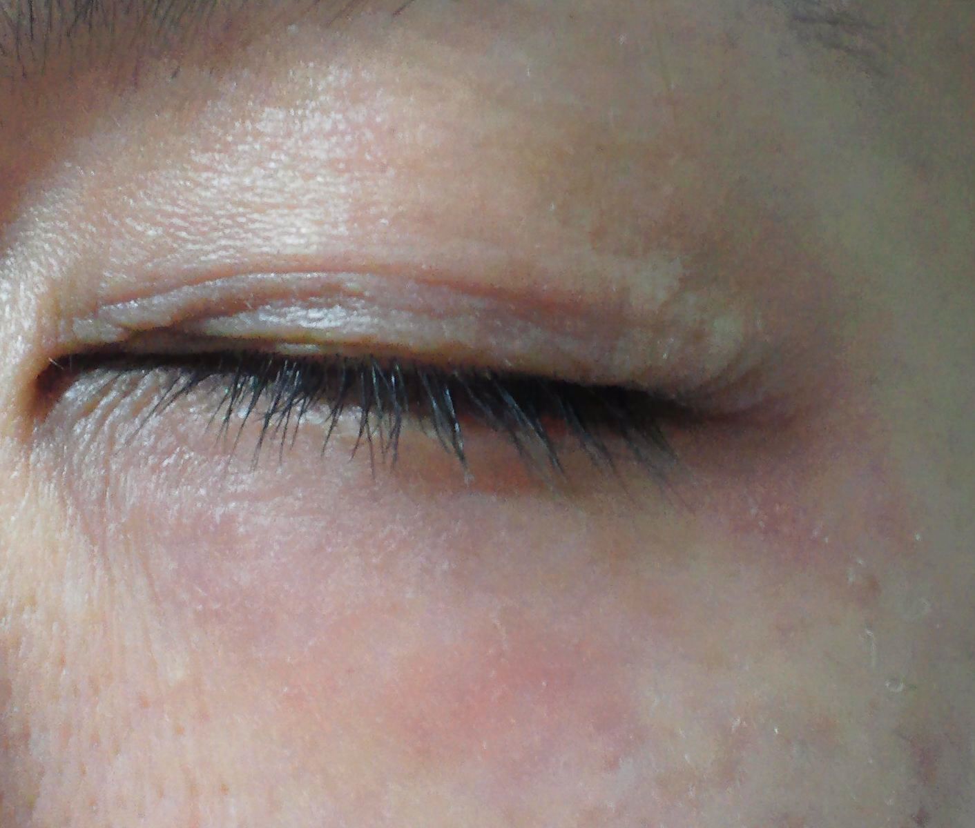 目 の 周り の かゆみ 目の周りがかゆい かゆみの原因と具体的な予防策を紹介