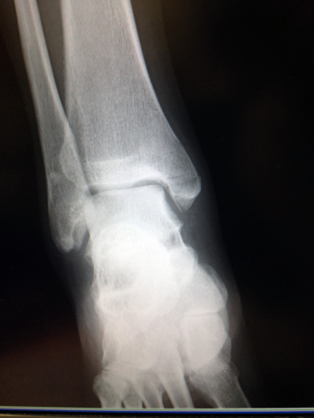 c0198263_16243846.jpg
