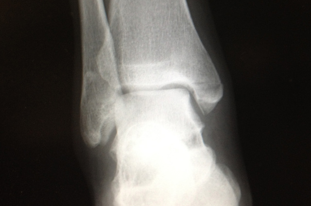 c0198263_16252639.jpg