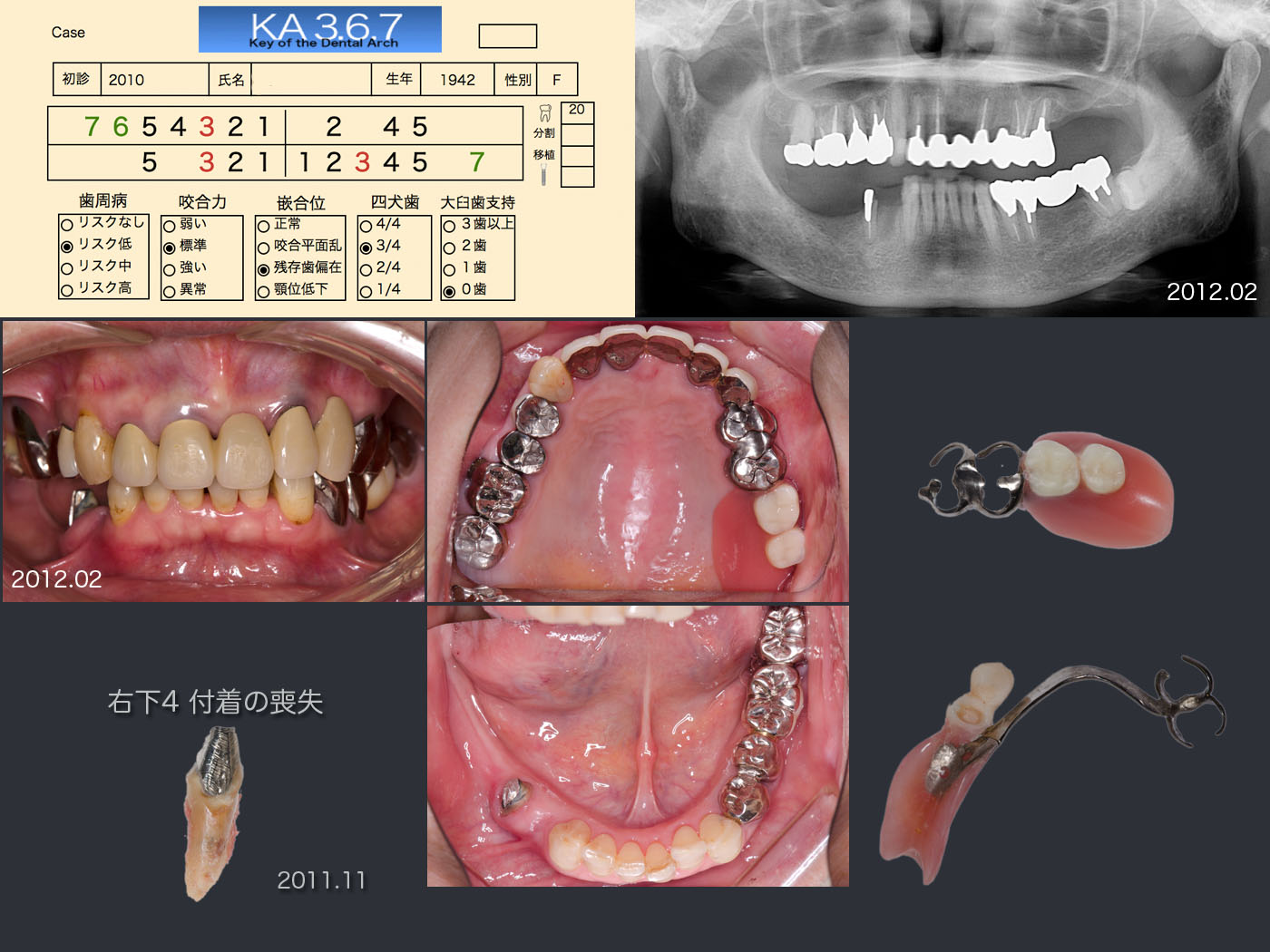 対角線の67欠損 : KA367 CLUB