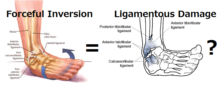 足首を捻ったら、治療すべきは本当に靱帯？―Distal Tibfib Joint Mobilizationsについて考える。_b0112009_863874.png