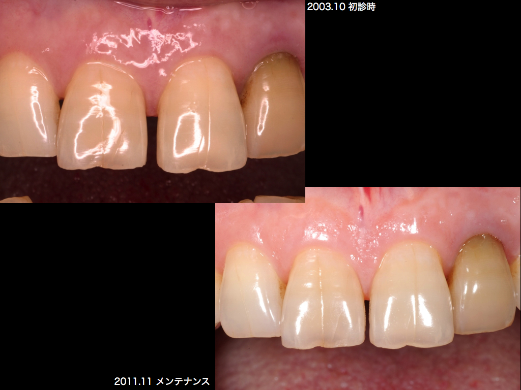 2012.11.06 メンテナンスを継続された患者さん_b0112648_21355415.jpg