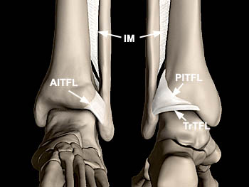 足首を捻ったら、治療すべきは本当に靱帯？―Distal Tibfib Joint Mobilizationsについて考える。_b0112009_9285961.jpg