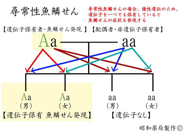 魚鱗癬は、子供にどのように遺伝するか？_d0096268_16573128.jpg