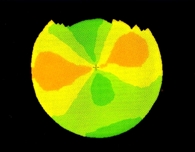 角膜トポグラフィー　　(646)_f0088231_18382695.jpg