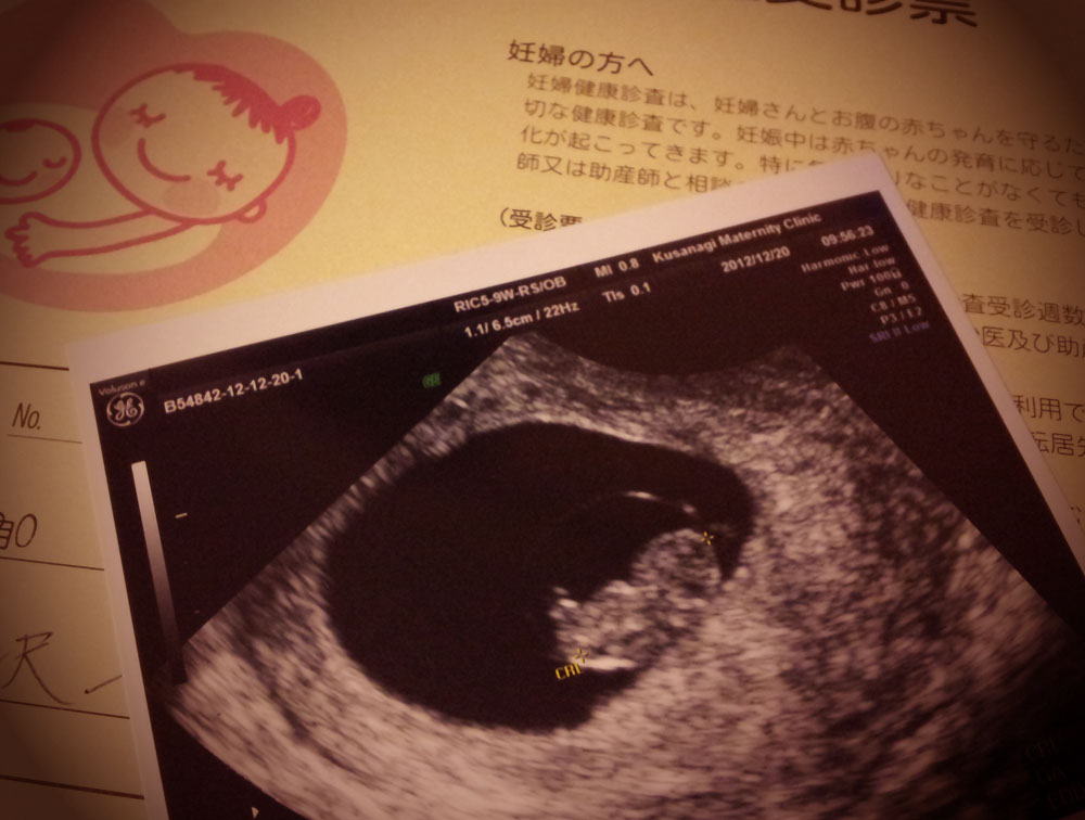 Second Child D Journal