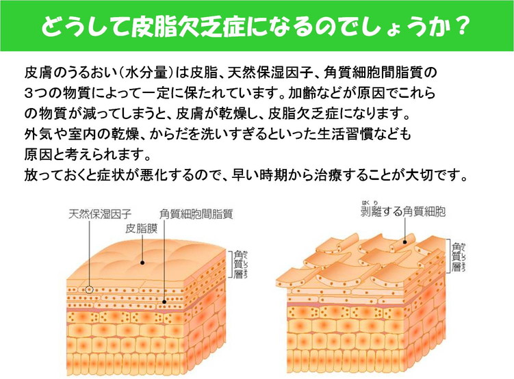 2012年12月25日教室　『ドライスキンケア』_c0219616_13375335.jpg