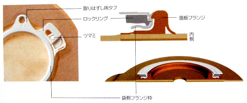 節約ストーマ生活 節約ストーマ生活