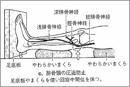マヒ 麻痺 知覚マヒ 感覚マヒ Eopoe Eyozheyuyaabchchl8 マヒ 麻痺 知覚マヒ 感覚マヒ Eopoe Eyozheyuyaabchchl8