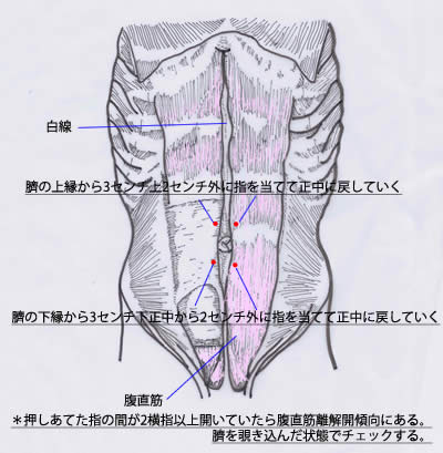 「腹直筋離解」　ひとりで操体法バリエーション_c0116614_2045512.jpg