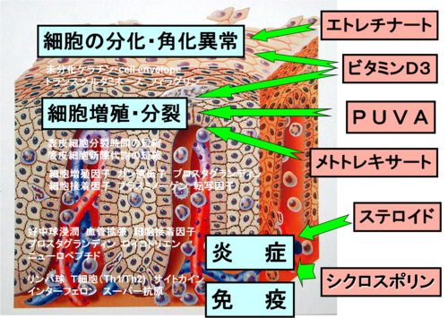 2013年1月22日教室　『生物学的製剤治療の今』_c0219616_1810488.png