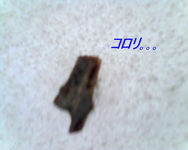 顕微鏡☆あくびの足にエイリアン;_e0195743_2194134.jpg