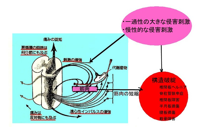 先取り鎮痛_b0052170_0284363.jpg