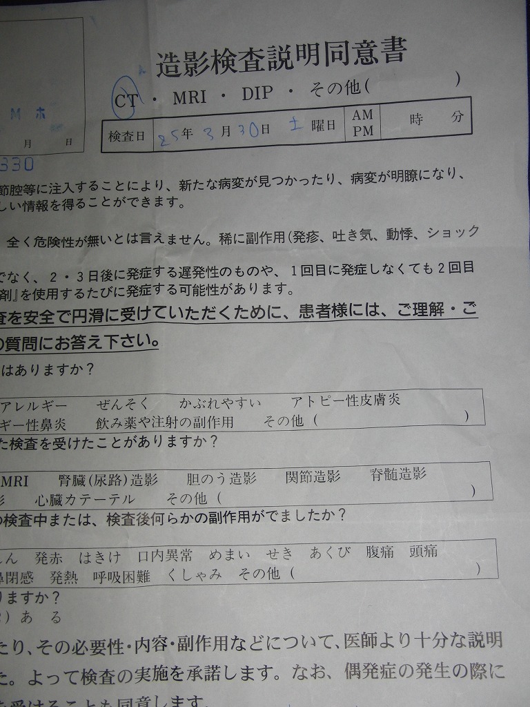 入院 憩室 炎