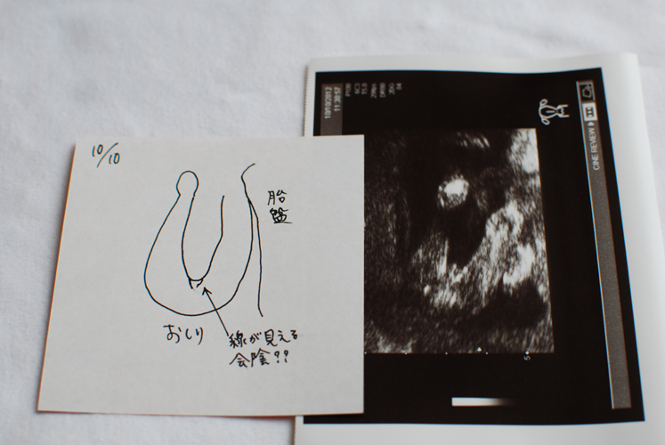 臨時エコー Honey S Baby Room