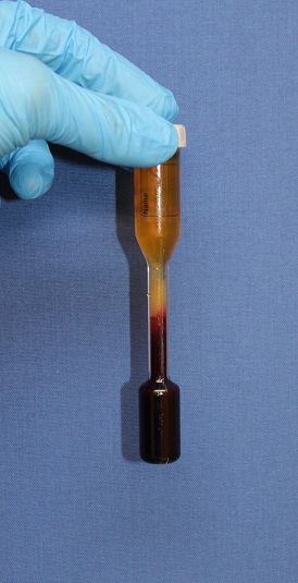 PPP(Platelet Poor Plasma) , PRP(Platelet Rich Plasma)_d0092965_1113690.jpg