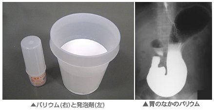 ▼バリウムこわい_d0017381_2238407.jpg