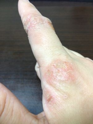 もしかて めんげん 冷え取りや日々のこと もしかて めんげん 冷え取りや日々のこと