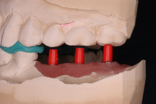 f0174854_9294216.jpg