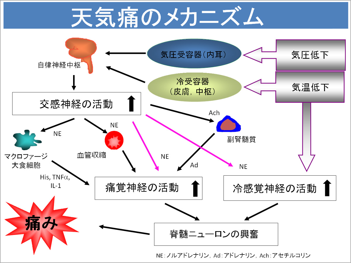 天気痛」のメカニズム② : 「脳‐身体‐心」の治療室