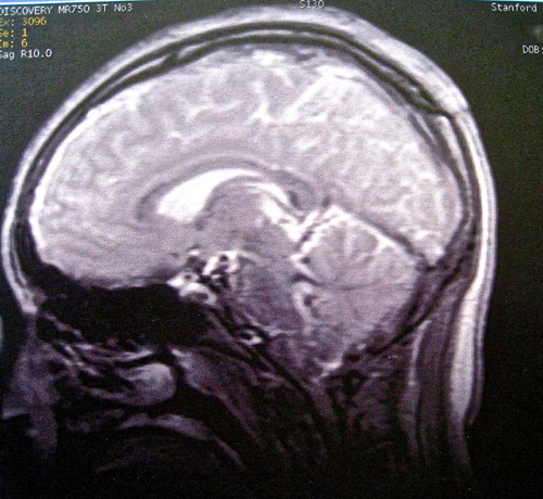 e0326991_11565523.jpg