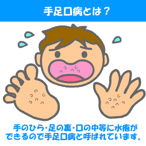 手足口病が日本で大流行しています グアム診療所 旅行者クリニック便り 手足口病が日本で大流行しています グアム診療所 旅行者クリニック便り