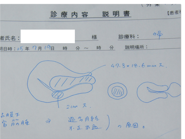 2 筋腫分娩 診断と術前検査 一部 そらたび 2 筋腫分娩 診断と術前検査 一部 そらたび