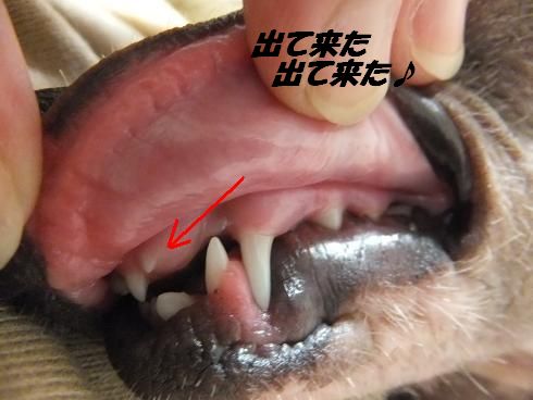 歯　（記録写真）_f0179203_9422122.jpg