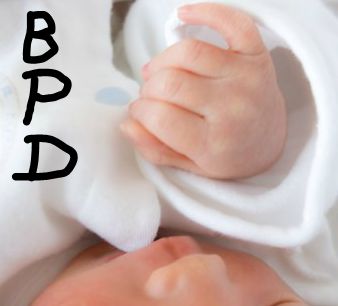 超低出生体重児に対する経鼻IPPVとCPAPにアウトカムの有意差なし_e0156318_13494951.jpg