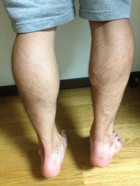趣味で短距離やる人のアキレス腱断裂記リハビリ編4 Soul 的陸上競技活動録
