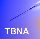 TBNAの成功を予測する因子_e0156318_1533078.jpg