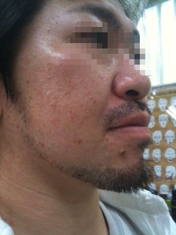 beard style vo.44 『ヒゲのビフォーアフター 3』_e0100332_11121195.jpg