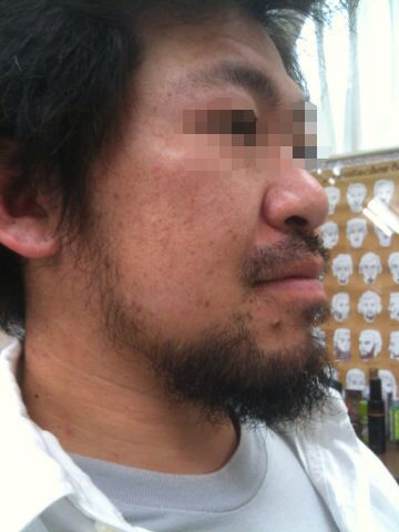 beard style vo.44 『ヒゲのビフォーアフター 3』_e0100332_11121757.jpg