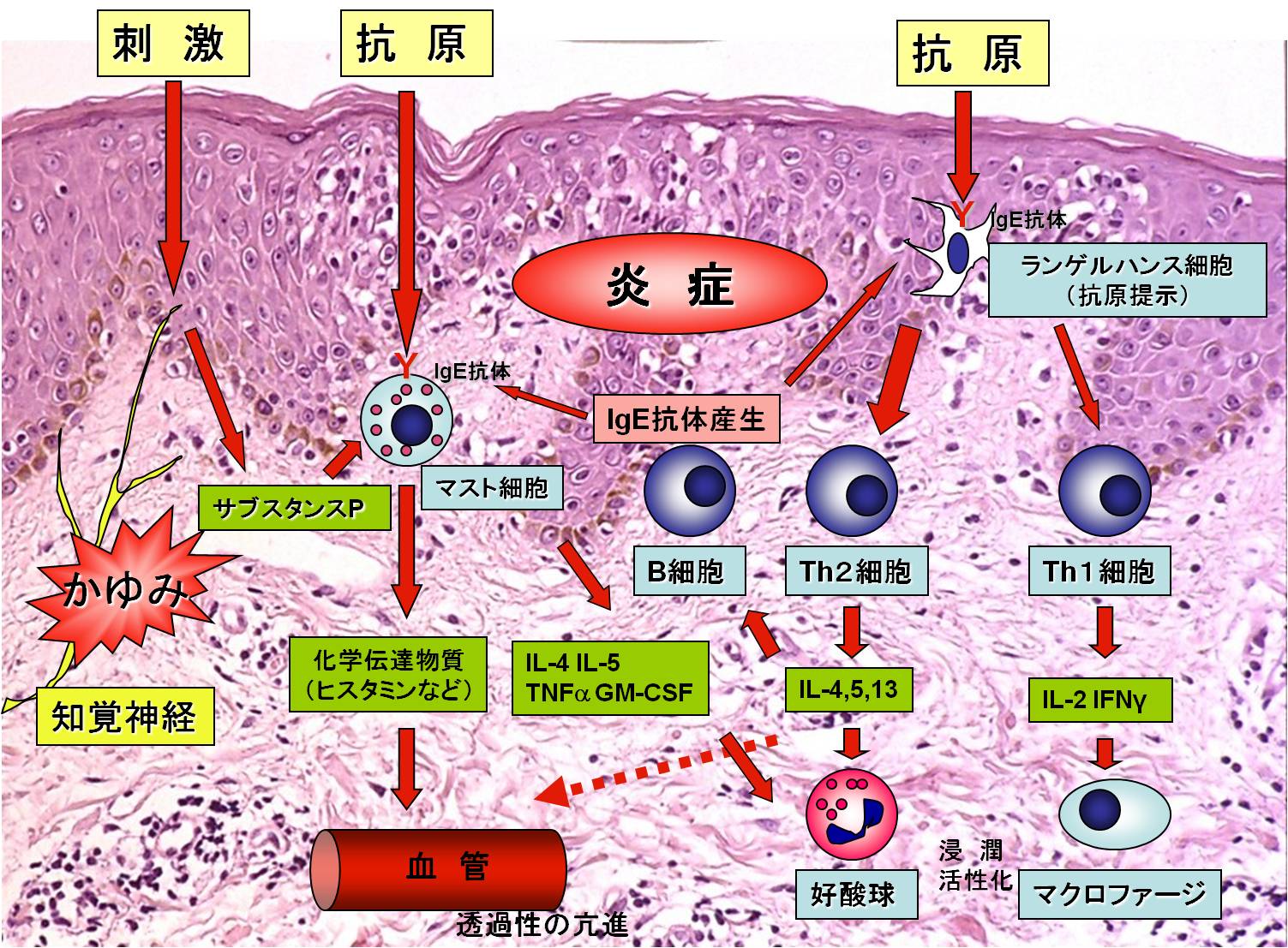 2013年8月教室 『さらに進化する乾癬治療、そしてアトピー性皮膚炎への応用』_c0219616_10554346.jpg