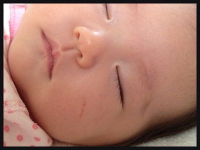 赤ちゃんの爪と回復力 Happy思考で素敵な毎日を 赤ちゃんの爪と回復力 Happy思考で素敵な毎日を