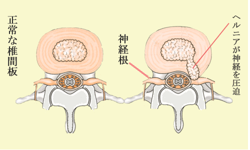 持病の話_a0201157_15455.gif