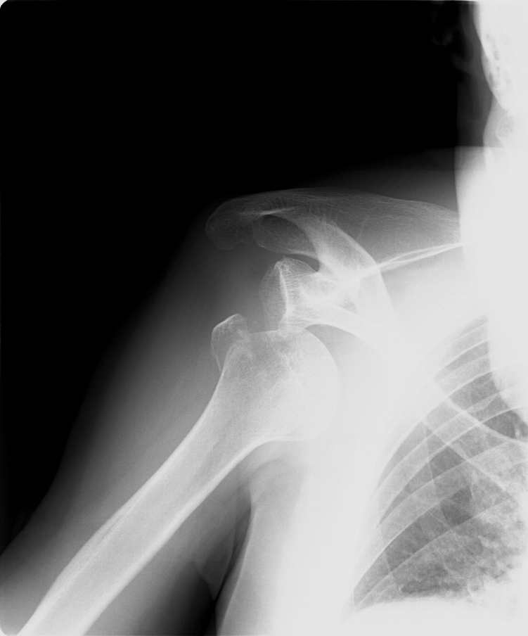 e0003910_21302045.jpg