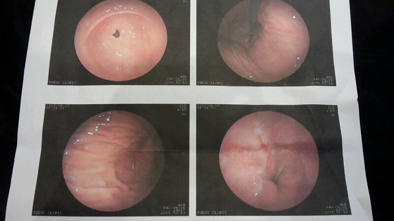 経鼻　胃カメラ検査　_d0092901_21434688.jpg