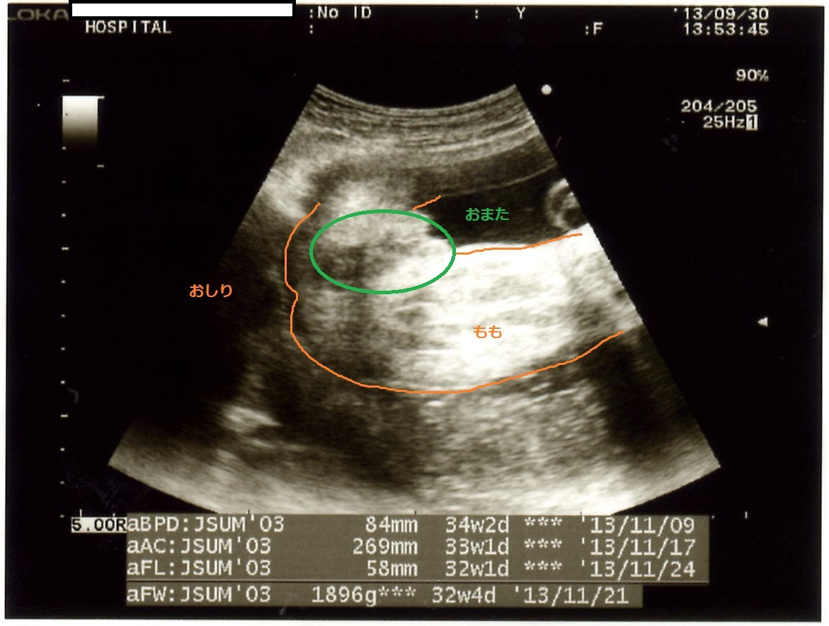 32w5d 妊婦健診 女の子エコー有 トマトの妊活 妊娠 出産
