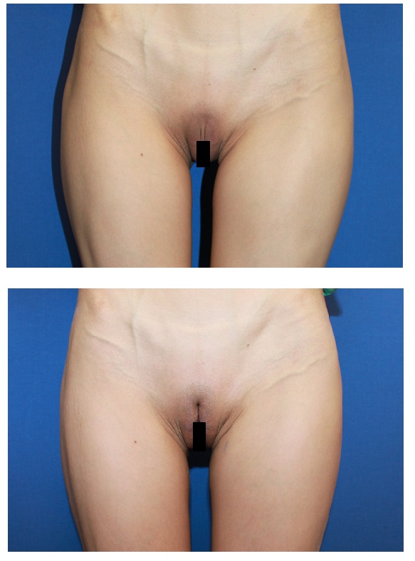 陰核まんこ無修正