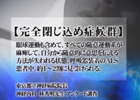 完全閉じ込め症候群 と言われるコミュニケーション障害者用に開発された装置 心語り の開発物語 久米さんの科学映像便り