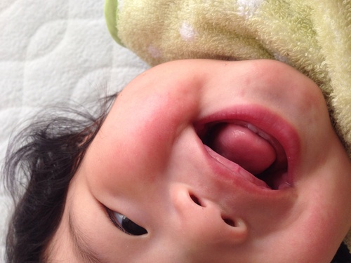 よだれ かぶれ ワセリン ワセリンでの赤ちゃんのあせも対策は有効なのか よだれ かぶれ ワセリン ワセリンでの赤ちゃんのあせも対策は有効なのか
