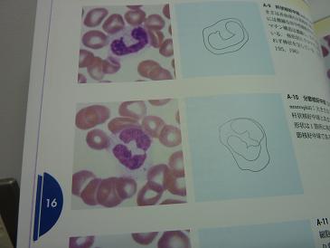 白血球の_d0165410_11414677.jpg