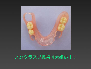 やっぱりノンクラスプ義歯は嫌いだ_d0148776_1991585.jpg